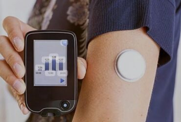 Flash Glucose Monitoring Technology